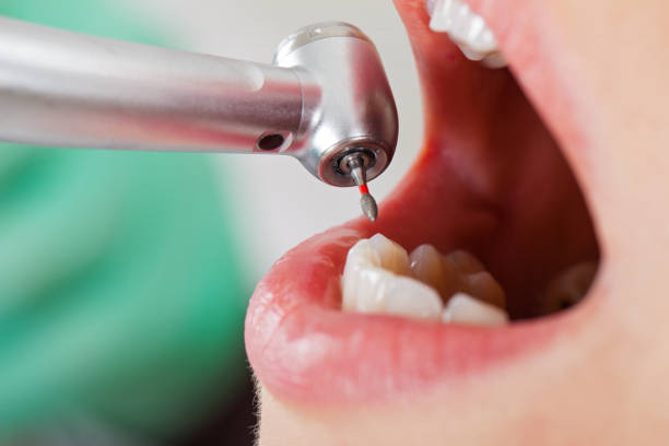 Best Pediatric Emergency Dentist in Leslie, MI